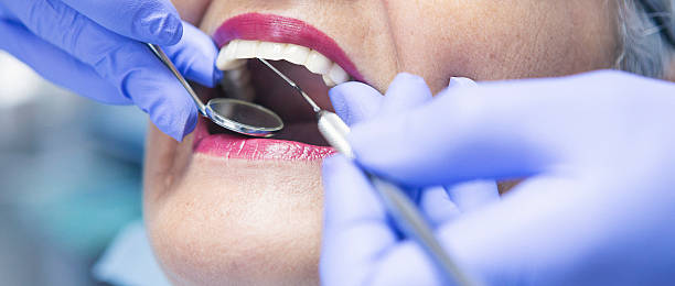 Best Urgent Care for Lost Fillings or Crowns in Kenner, LA